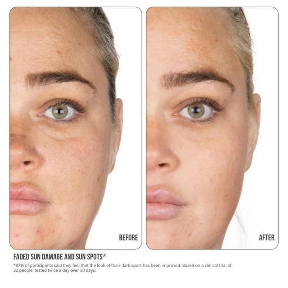 NIP+FAB Facial Bundle: Vitamin C Tonic & Retinol Fix Blemish Treatment - Picture 3 of 8